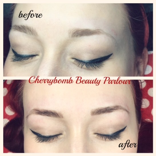 This photo is from my first treatment, I will share an updated photo as soon as I can.